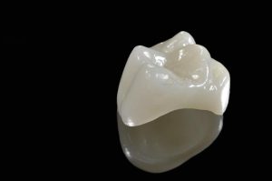Crowns - Dental Loomis